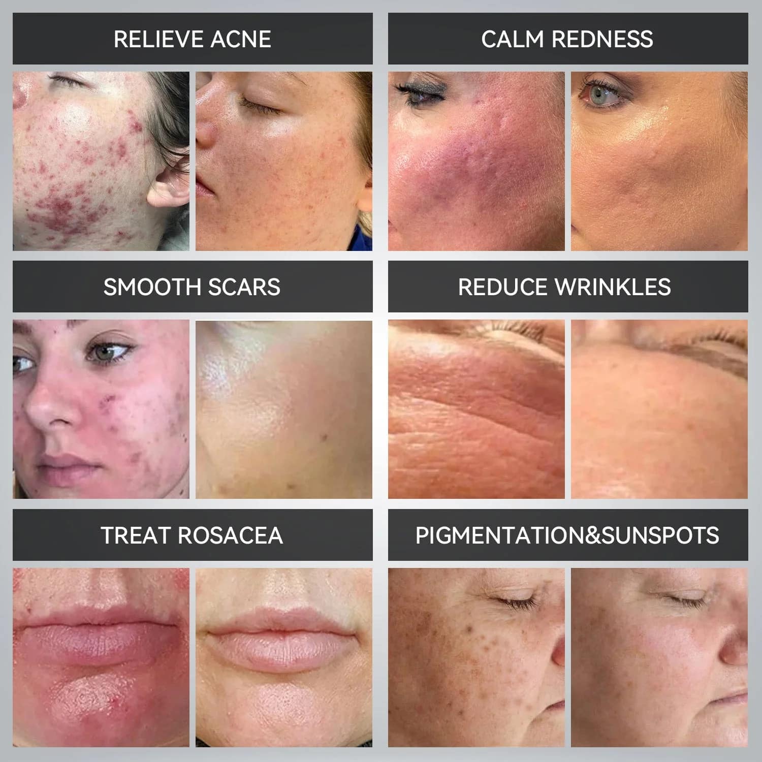 LED Light Therapy System LED Light Therapy System - Image 5