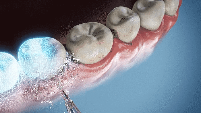 Cordless Oral Water Flosser